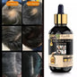 Rootandremedy Anti-Hair Loss Lotion Serum for hair Growth and stop hair fall-30ML (Pack of 2pcs)